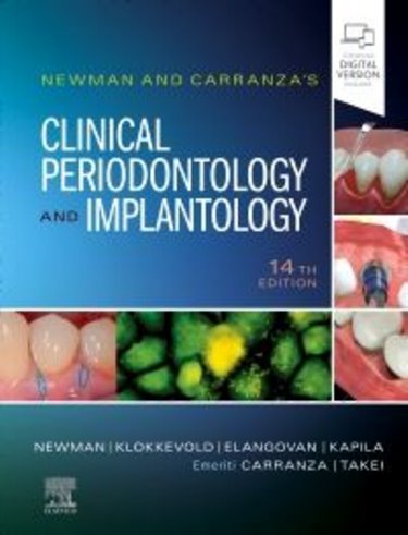 Newman and Carranzas Clinical Periodontology and Implantology. Text with Digital Version Cover Image