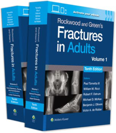 Rockwood and Greens Fractures in Adults. 2 Volume Set. Text with Access Code Cover Image