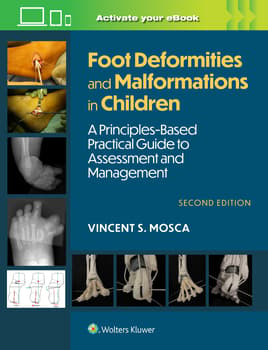 Foot Deformities and Malformations in Children: A Principles-Based, Practical Guide to Assessment and Management. Text with Access Code Cover Image