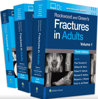 Rockwood and Greens Fractures in Adults. Rockwood and Wilkins Fractures in Children. 3 Volume Set. Text with Access Code Cover Image