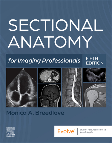 Sectional Anatomy for Imaging Professionals Cover Image