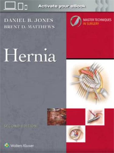 Master Techniques in Surgery: Hernia Surgery. Text with Internet Access Code for Companion Website Cover Image