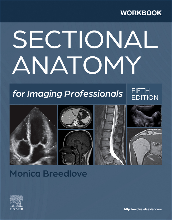 Workbook for Sectional Anatomy for Imaging Professionals Cover Image
