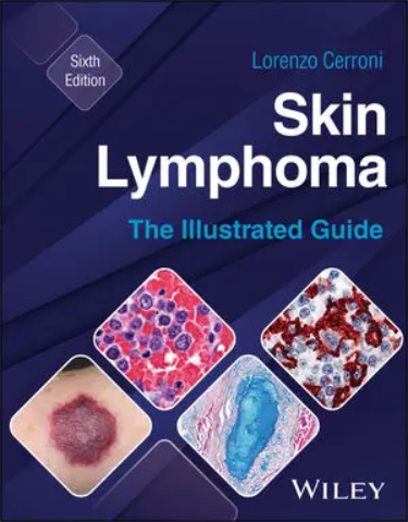 Skin Lymphoma: The Illustrated Guide Cover Image