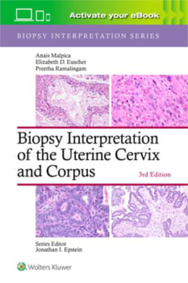Biopsy Interpretation of the Uterine Cervix and Corpus. Text with Access Code Cover Image
