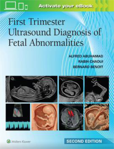 First Trimester Ultrasound Diagnosis of Fetal Abnormalities Cover Image