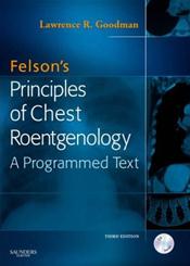Felsons Principles of Chest Roentgenology. Text with CD-Rom for Windows and Macintosh Cover Image