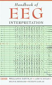 Handbook of EEG Interpretation Cover Image