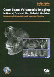 Cone-beam Volumetric Imaging in Dental, Oral and Maxillofacial Medicine: Fundamentals, Diagnostics and Treatment Planning. Text with DVD Cover Image