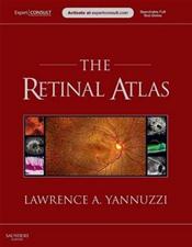Retinal Atlas. Text with Internet Access Code for ExpertConsult Website Cover Image