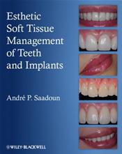 Esthetic Soft Tissue Management of Teeth and Implants Cover Image