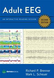 Adult EEG: An Interactive Reading Session on DVD-ROM for Windows and Macintosh Cover Image