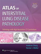 Atlas of Interstitial Lung Disease Pathology: Pathology with High Resolution CT Correlations. Text with Access Code Cover Image
