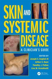 Skin and Systemic Disease: A Clinicians Guide Cover Image