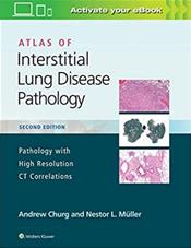 Atlas of Interstitial Lung Disease Pathology: Pathology with High Resolution CT Correlations. Text with Access Code Cover Image