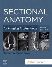 Sectional Anatomy for Imaging Professionals Cover Image