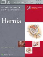 Master Techniques in Surgery: Hernia Surgery. Text with Internet Access Code for Companion Website Cover Image