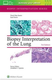 Biopsy Interpretation of the Lung. Text with Access Code Cover Image