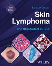 Skin Lymphoma: The Illustrated Guide Cover Image