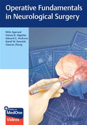 Operative Fundamentals in Neurological Surgery Cover Image