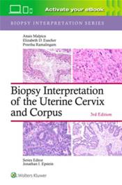 Biopsy Interpretation of the Uterine Cervix and Corpus. Text with Access Code Cover Image