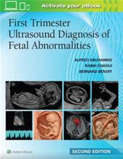 First Trimester Ultrasound Diagnosis of Fetal Abnormalities Cover Image