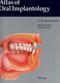 Oral Implantology: Basics, ITI Hollow Cylinder System Cover Image