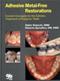 Adhesive Metal-Free Restorations: Current Concepts for the Esthetic Treatment Cover Image