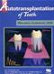 Autotransplantation of Teeth Cover Image