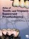 Atlas of Tooth and Implant-Supported Prosthodontics Cover Image