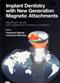 Implant Dentistry with New Generation Magnetic Attachments: Maximum Results with a Minimum Number of Implants Cover Image