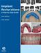 Implant Restorations: A Step-By-Step Guide Cover Image