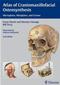 Atlas of Craniomaxillofacial Osteosynthesis: Microplates, Miniplates, and Screws Cover Image