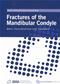 Fractures of the Mandibular Condyle: Basic Considerations and Treatment Cover Image