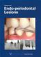 Endo-periodontal Lesions Cover Image