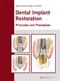 Dental Implant Restoration: Principles and Procedures Cover Image