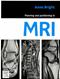 Planning and Positioning in MRI Cover Image