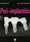 Peri-implantitis Cover Image