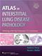 Atlas of Interstitial Lung Disease Pathology: Pathology with High Resolution CT Correlations. Text with Access Code Cover Image