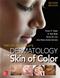 Taylor and Kellys Dermatology for Skin of Color Cover Image