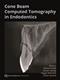 Cone Beam Computed Tomography in Endodontics Cover Image