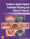 Evidence-Based Implant Treatment Planning and Clinical Protocols Cover Image