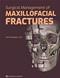Surgical Management of Maxillofacial Fractures Cover Image