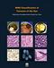 WHO Classification of Tumours of the Eye Cover Image
