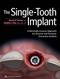 Single-Tooth Implant: A Minimally Invasive Approach for Anterior and Posterior Extraction Sockets Cover Image