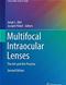 Multifocal Intraocular Lenses: The Art and the Practice Cover Image