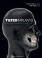 Tilted Implants: Implant-Prosthetic Rehabilation of the Atrophic Patient Cover Image