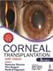 Corneal Transplantation Cover Image