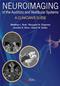 Neuroimaging of the Auditory and Vestibular Systems: A Clinicians Guide Cover Image