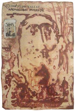 Haemoglobin Series - I